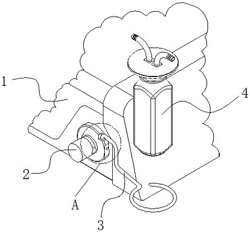 An ultrasonic negative pressure stone removal device in the body