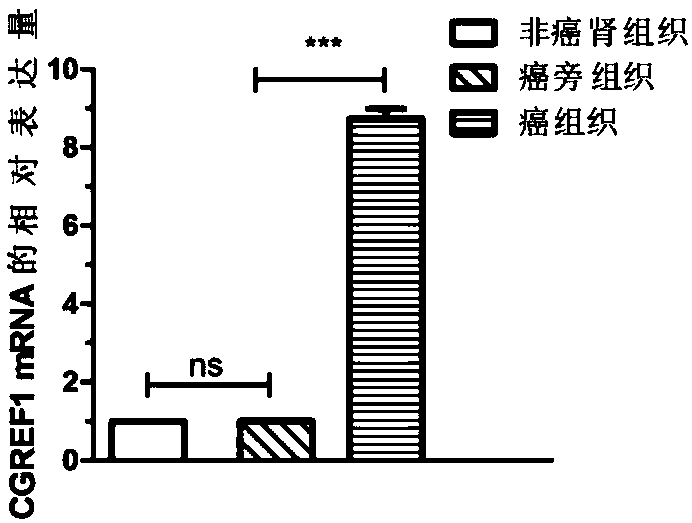 Application of CGREF1 as marker in diagnosis and treatment of renal clear cell carcinoma