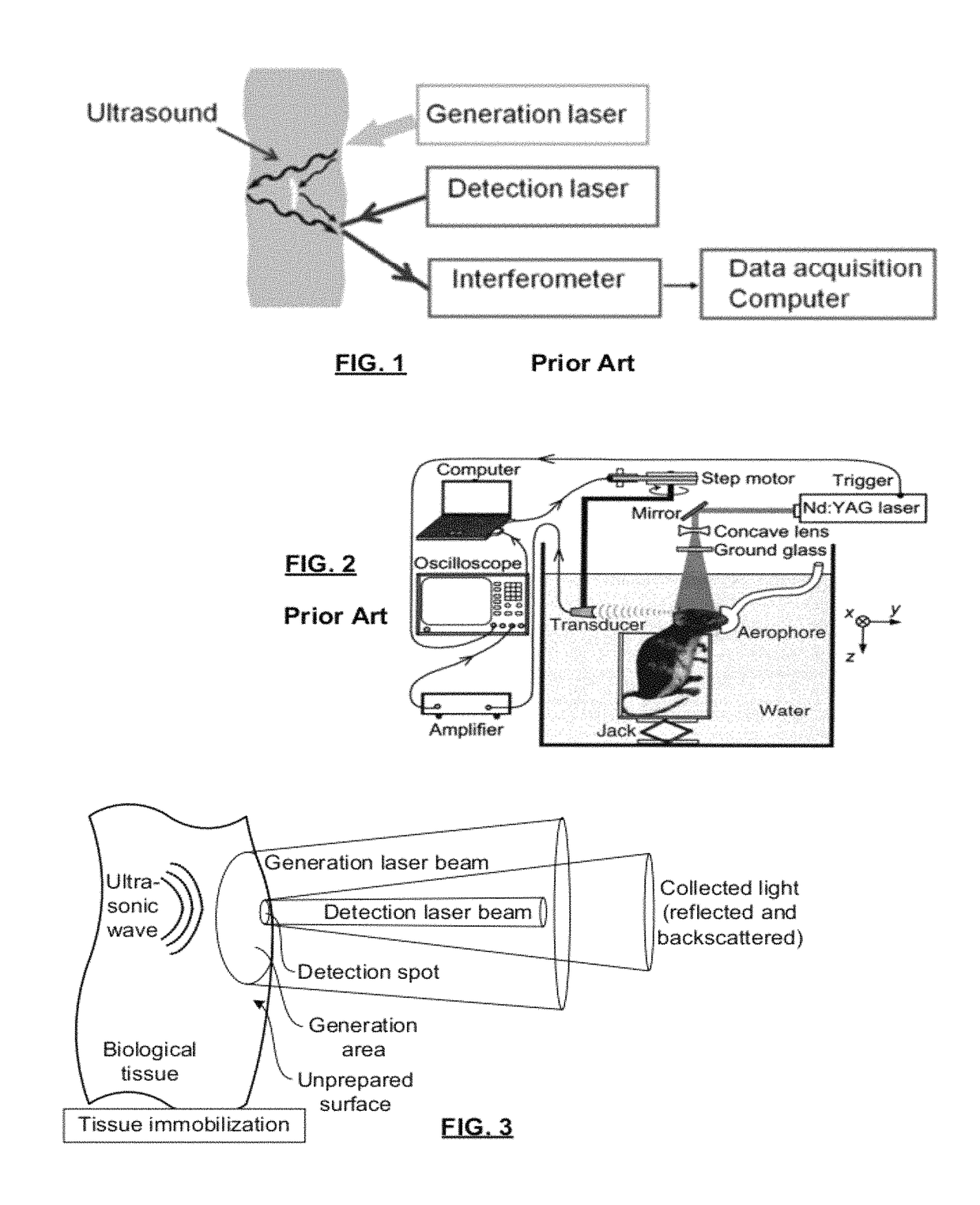 Biological tissue inspection method and system