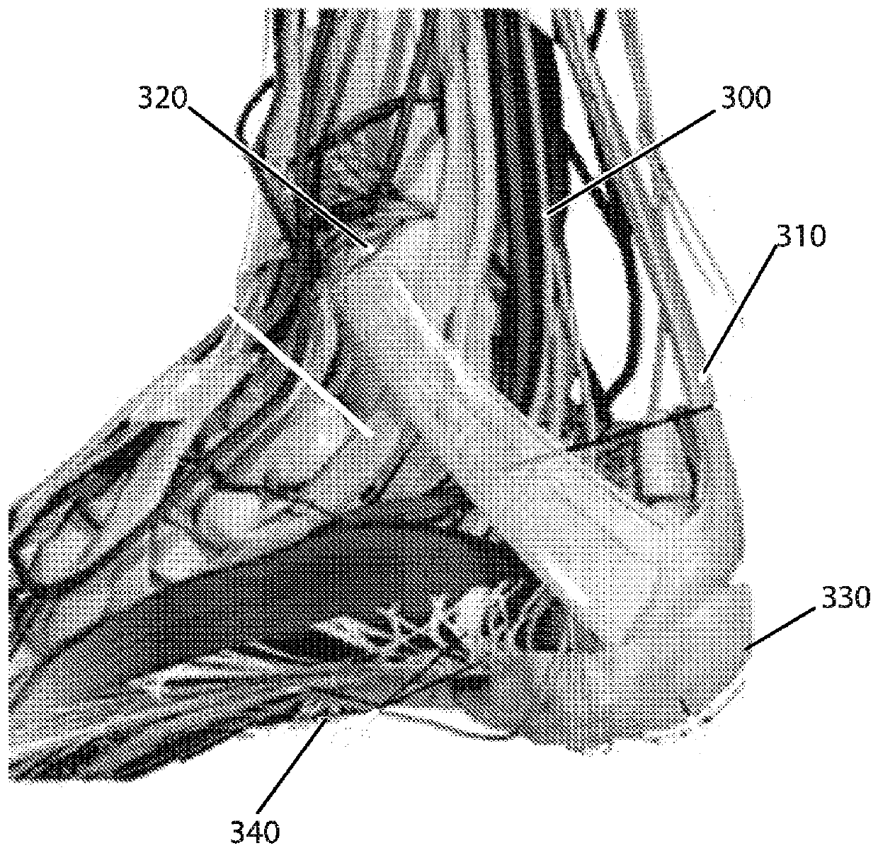 Topical nerve stimulation device