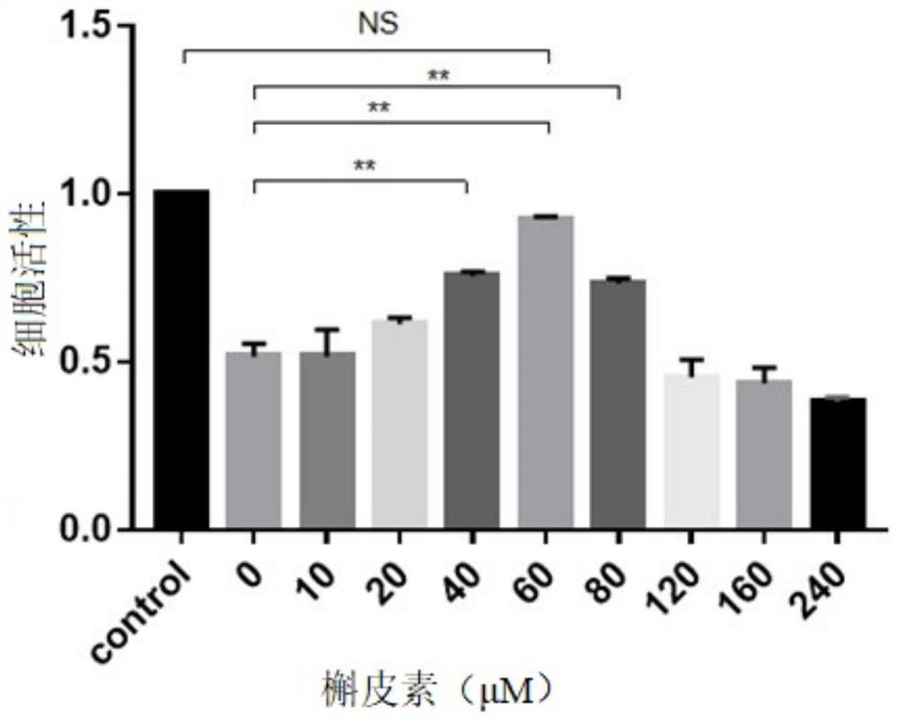 Application of quercetin in preparation of medicine for treating intervertebral disc nucleus pulposus degeneration