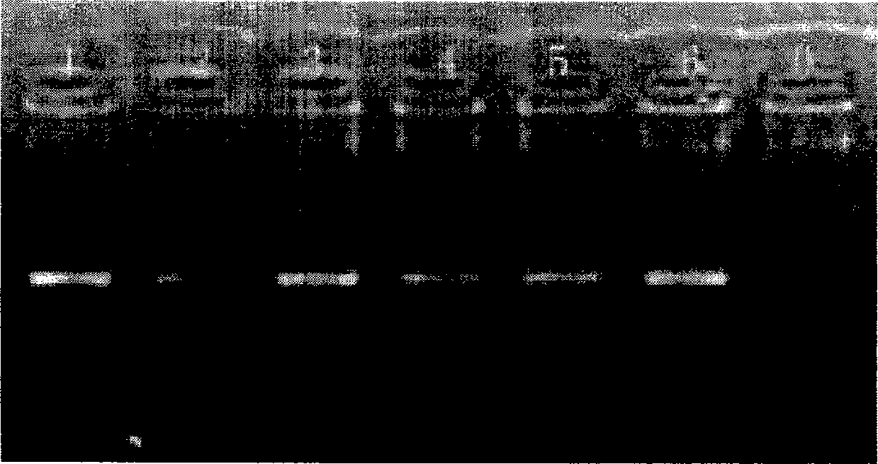 Detection kit for nucleoside analogue drug-resistant correlated mutation of hepatitis B viruses