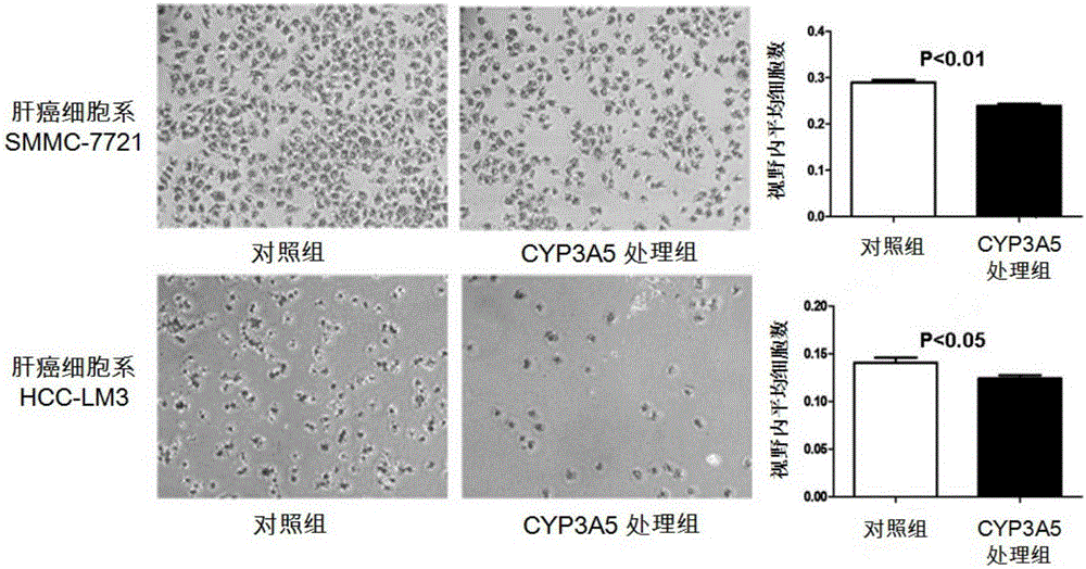 CYP3A5 protein, encoding gene and recombinant vector and application thereof in preparing drugs for resisting tumor recurrence or metastasis