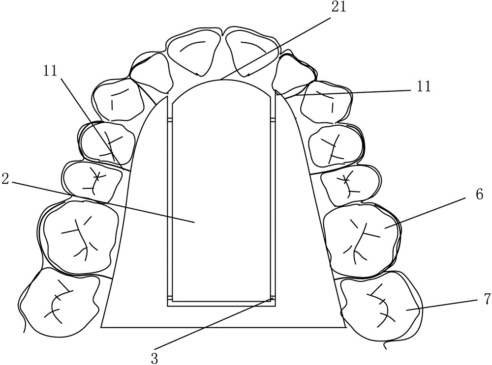 Functional snore guard