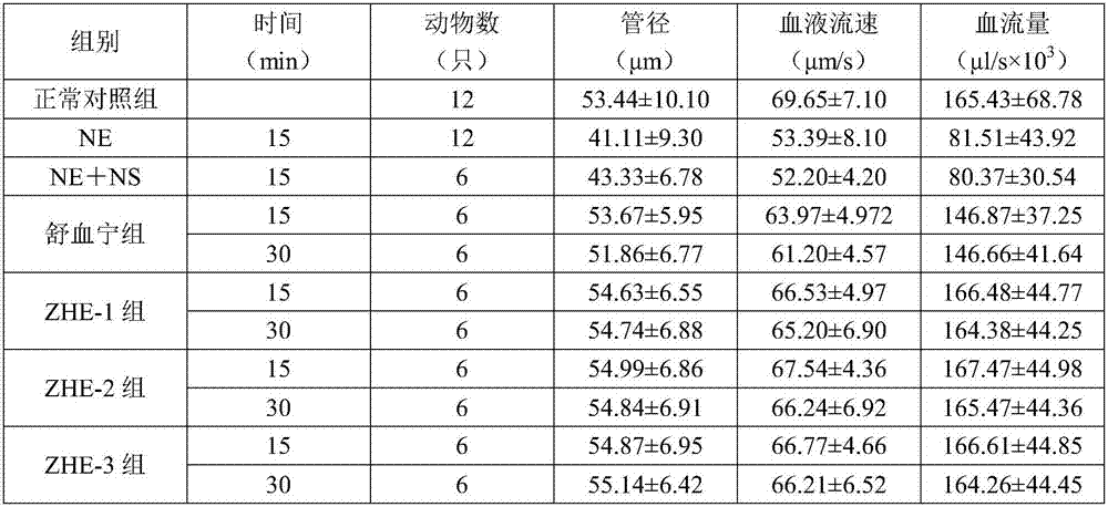 Pharmaceutical composition having effect of improving blood circulation as well as application of pharmaceutical composition and injection prepared and formed by pharmaceutical composition