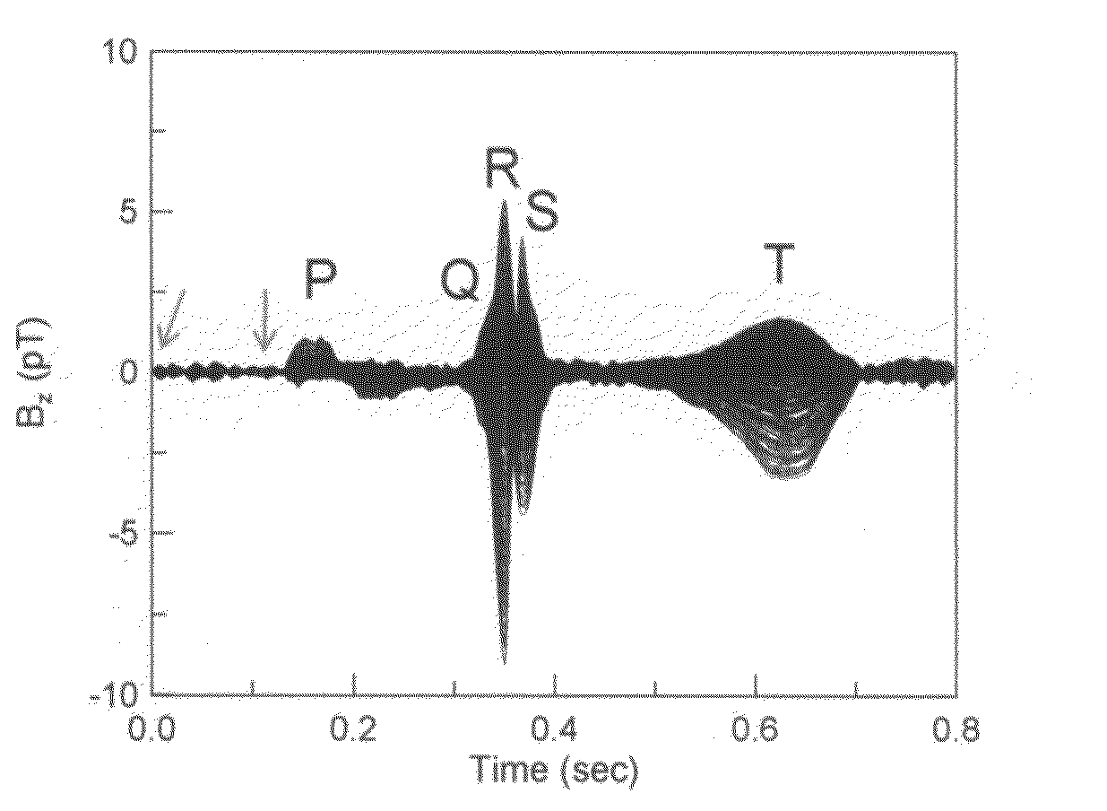 Method of examining dynamic cardiac electromagnetic activity and detection of cardiac functions using results thereof