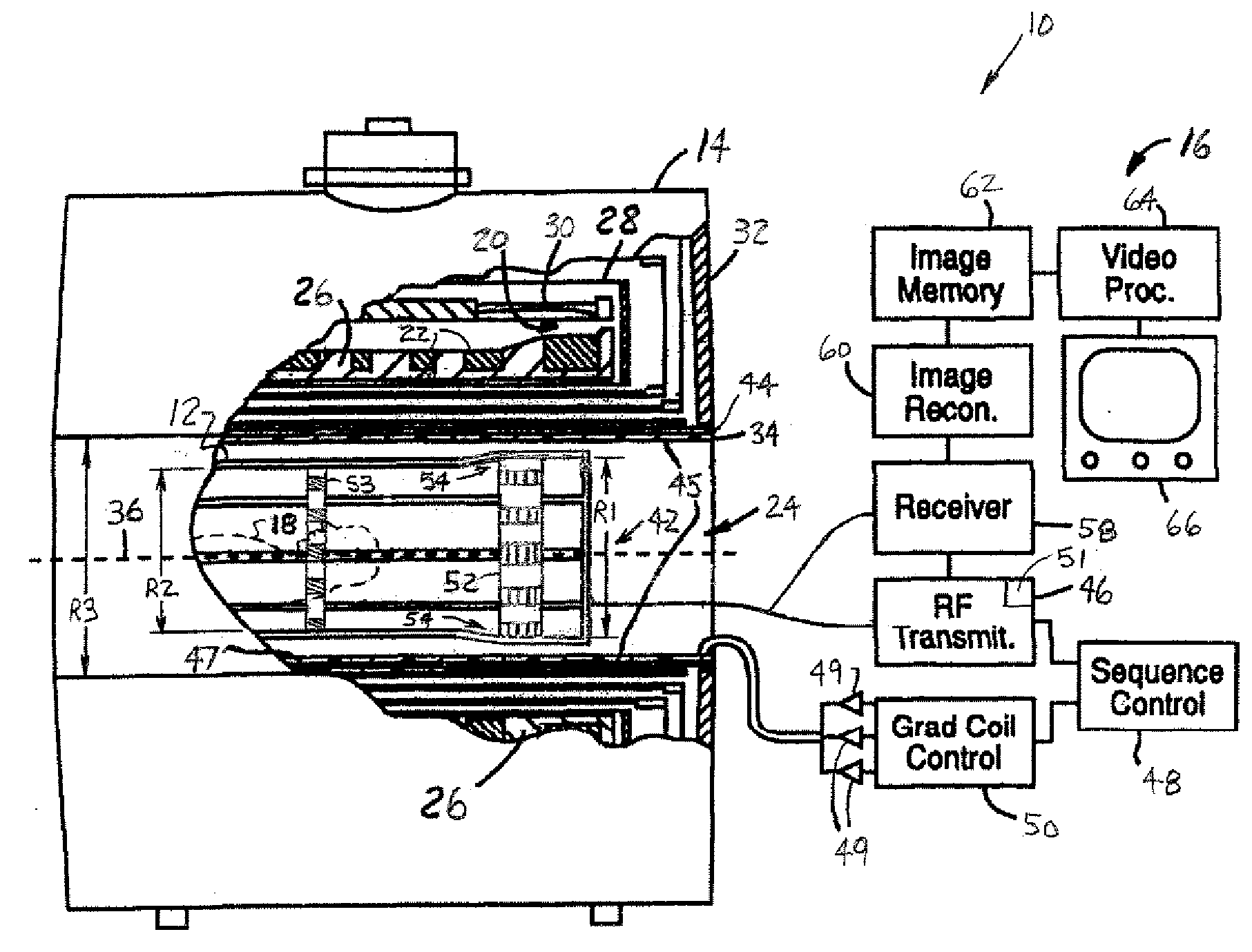 Elevated Endring Birdcage Antenna For MRI Applications