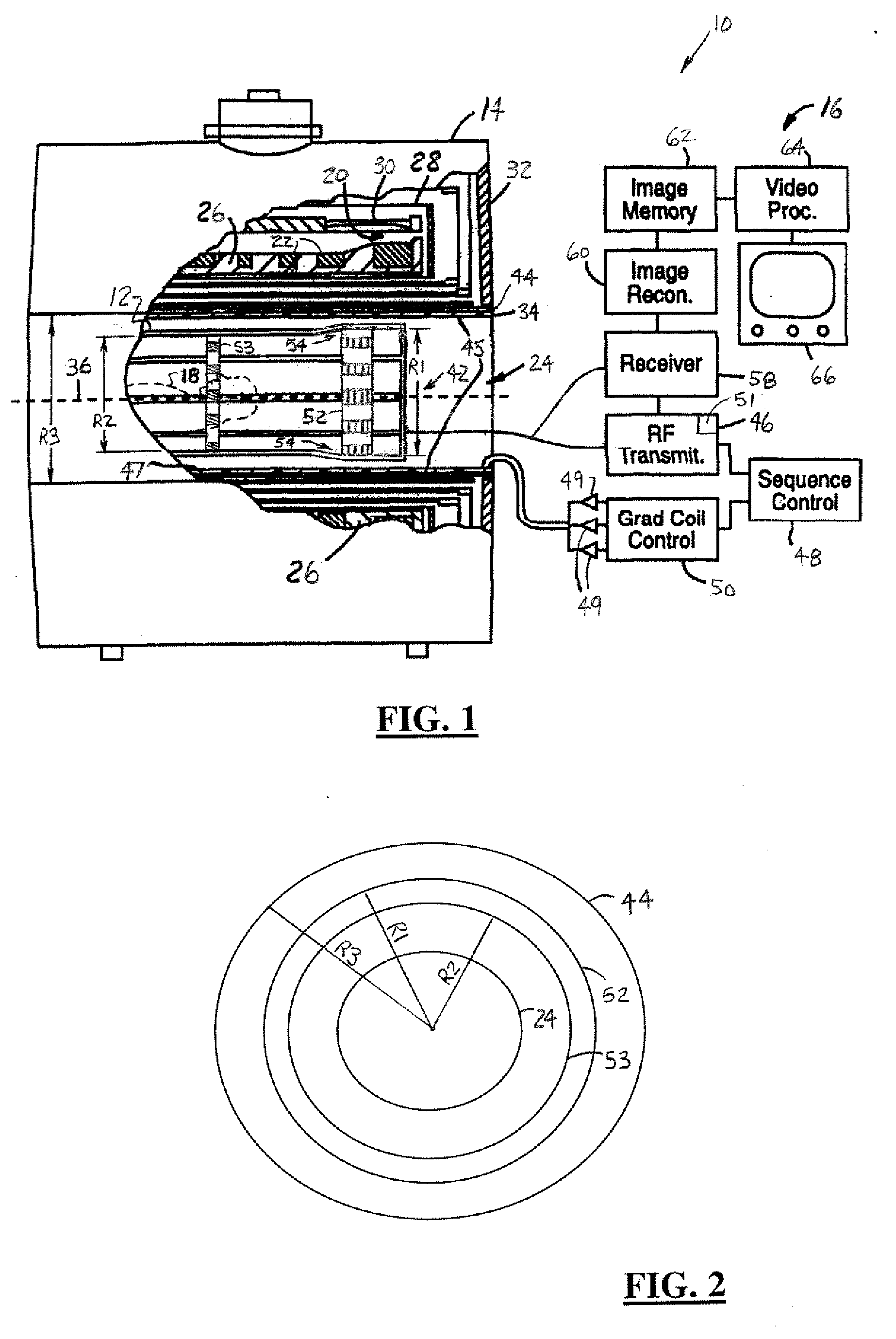 Elevated Endring Birdcage Antenna For MRI Applications