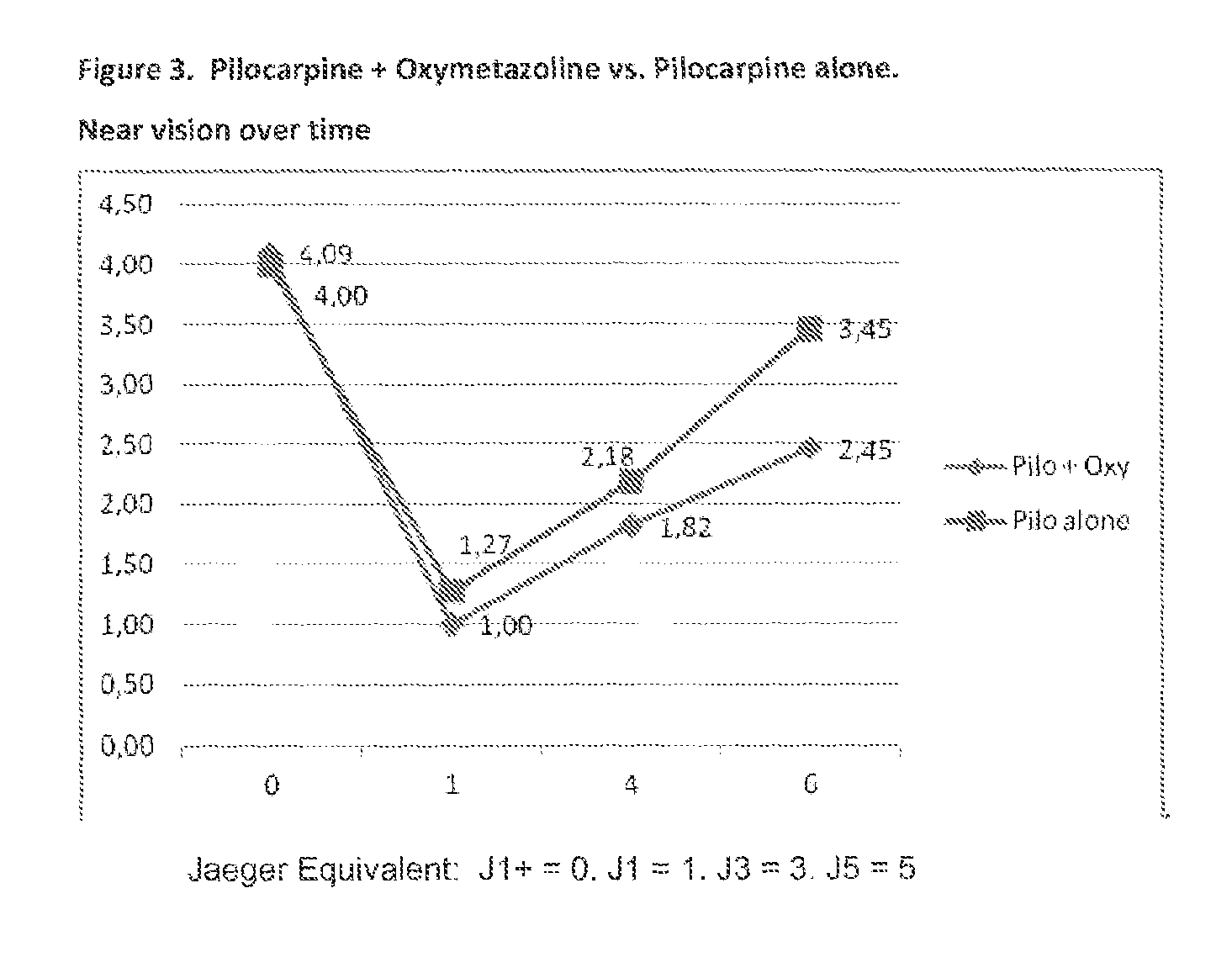 Compositions and methods for treating presbyopia, mild hyperopia, and irregular astigmatism