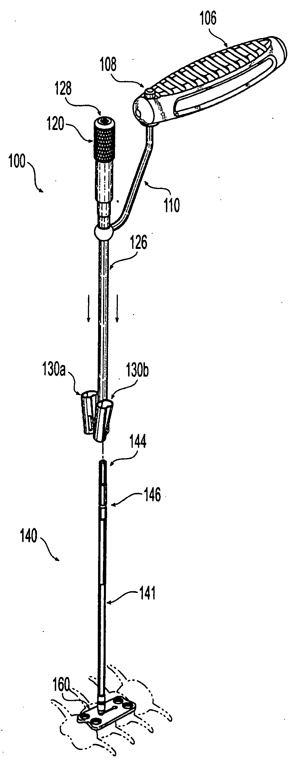 Plating system with compression drill guide