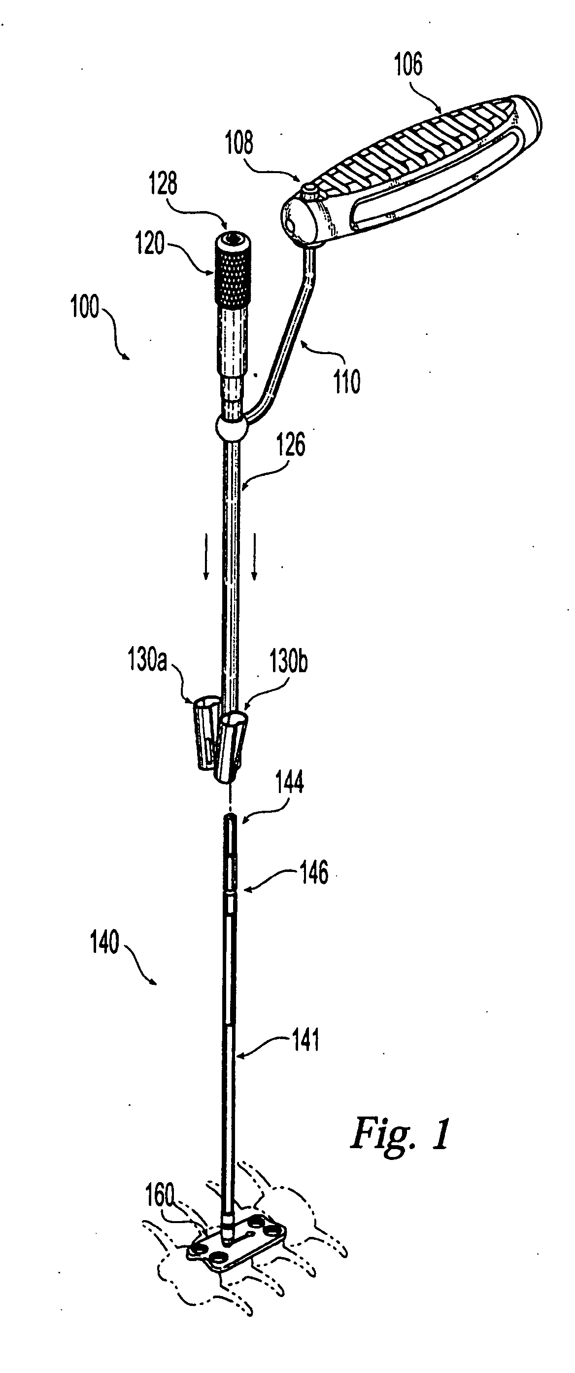 Plating system with compression drill guide