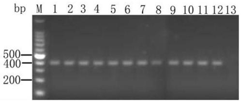 Severe fever with thrombocytopenia syndrome virus (SFTSV) inhibitor and application thereof