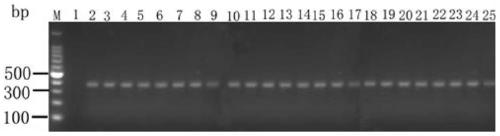 Severe fever with thrombocytopenia syndrome virus (SFTSV) inhibitor and application thereof