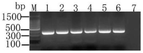 Severe fever with thrombocytopenia syndrome virus (SFTSV) inhibitor and application thereof