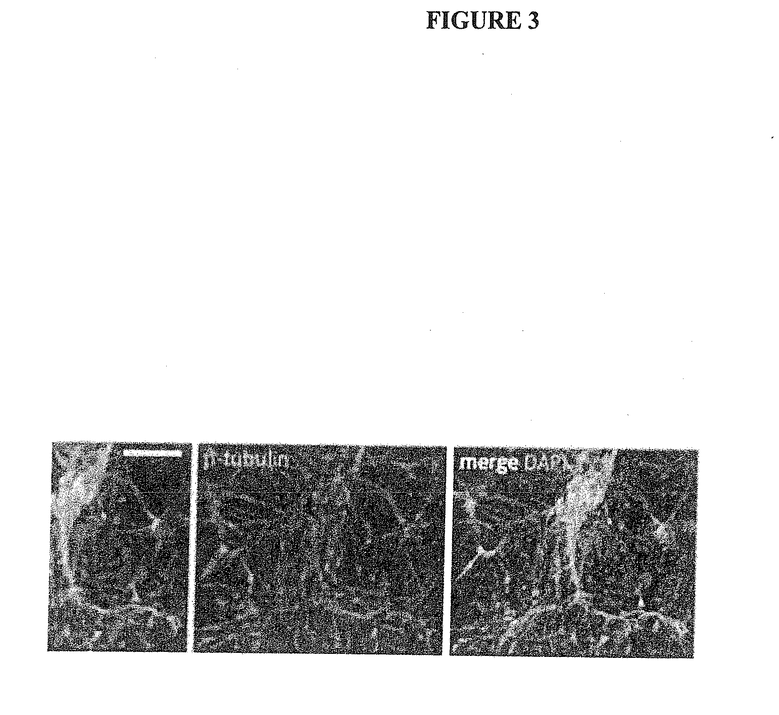 Differentiation of human pluripotent stem cells to multipotent neural crest cells