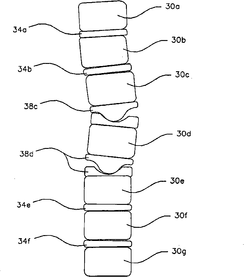 Multi-lobe artificial spine joint