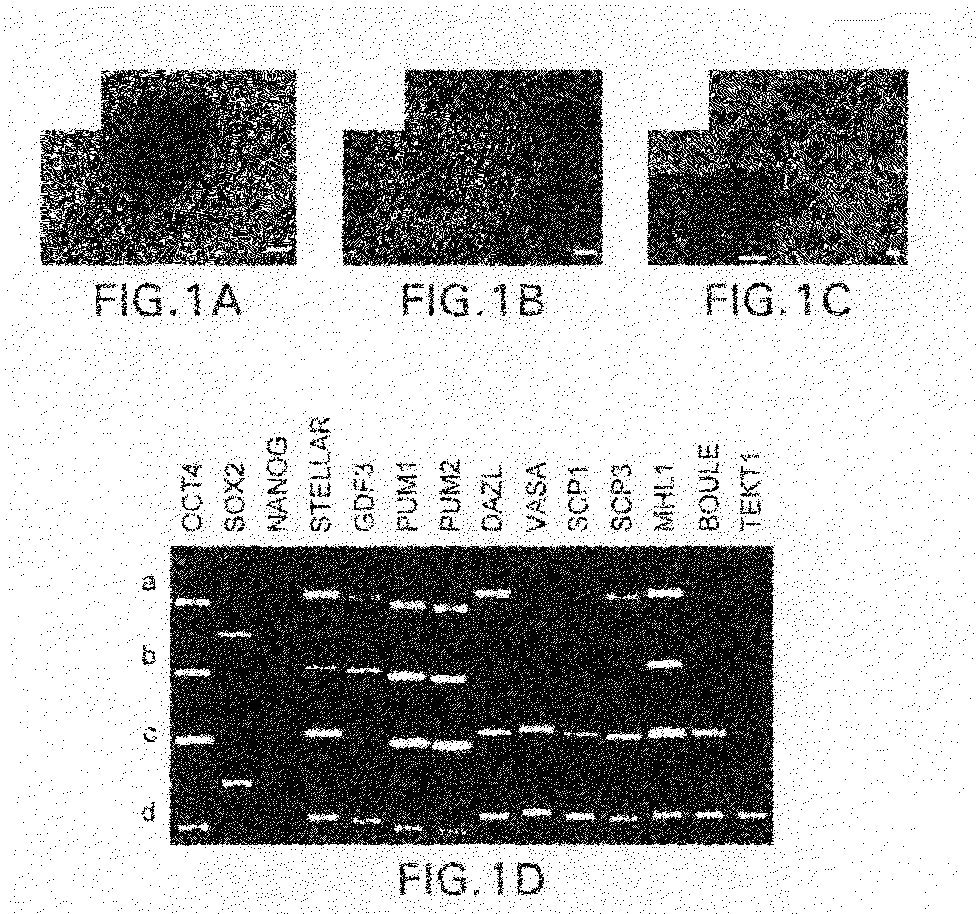 Isolation, characterization and differentiation of in vitro adult human germ line stem cells