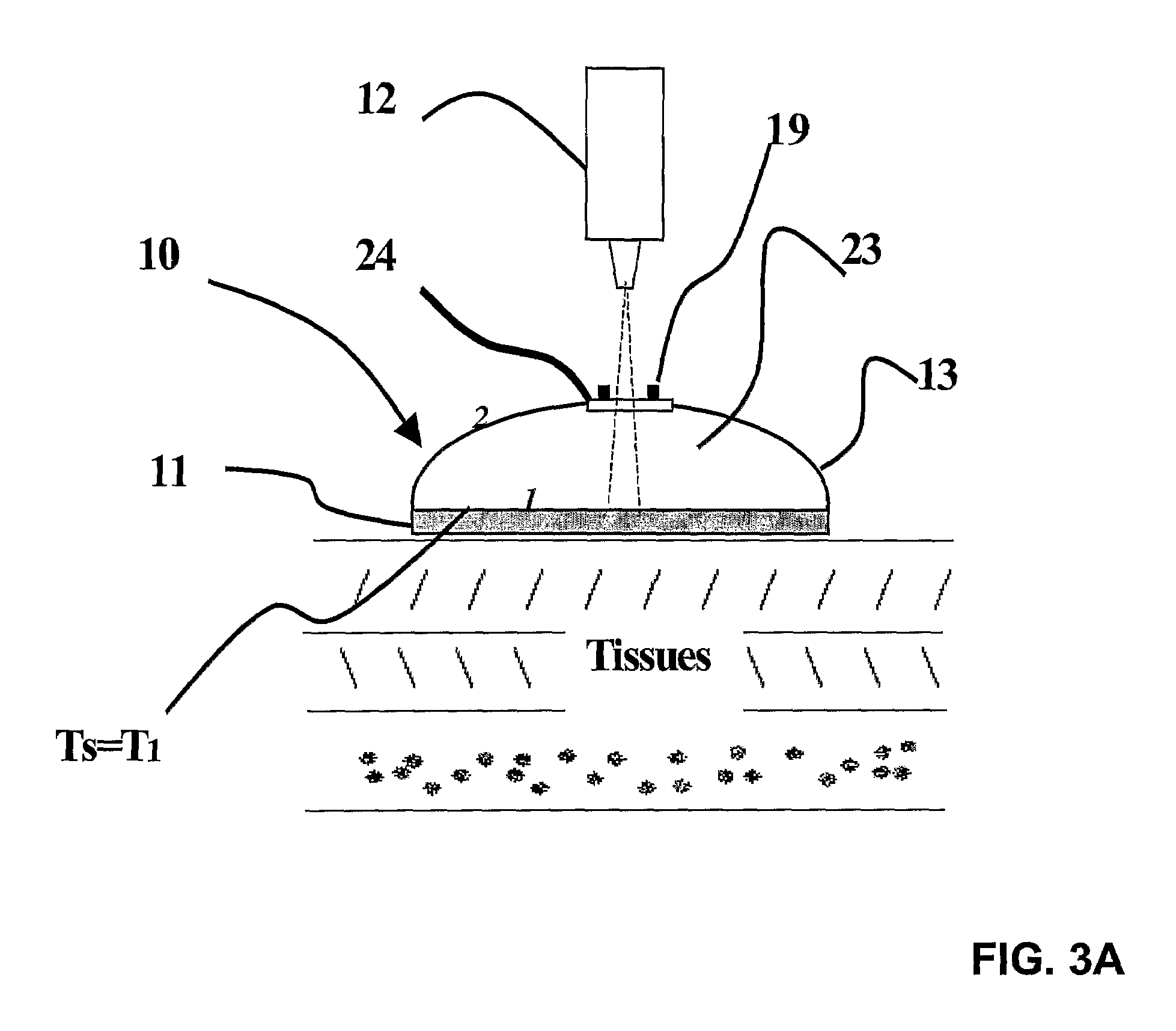 Temperature measurement device