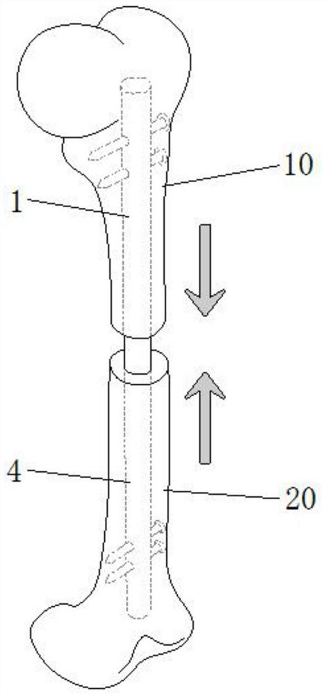 Magnetism driving epiphysis traction and pressurization device