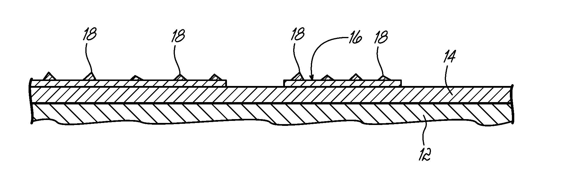 Method of treating cholangiocarcinoma and apparatus