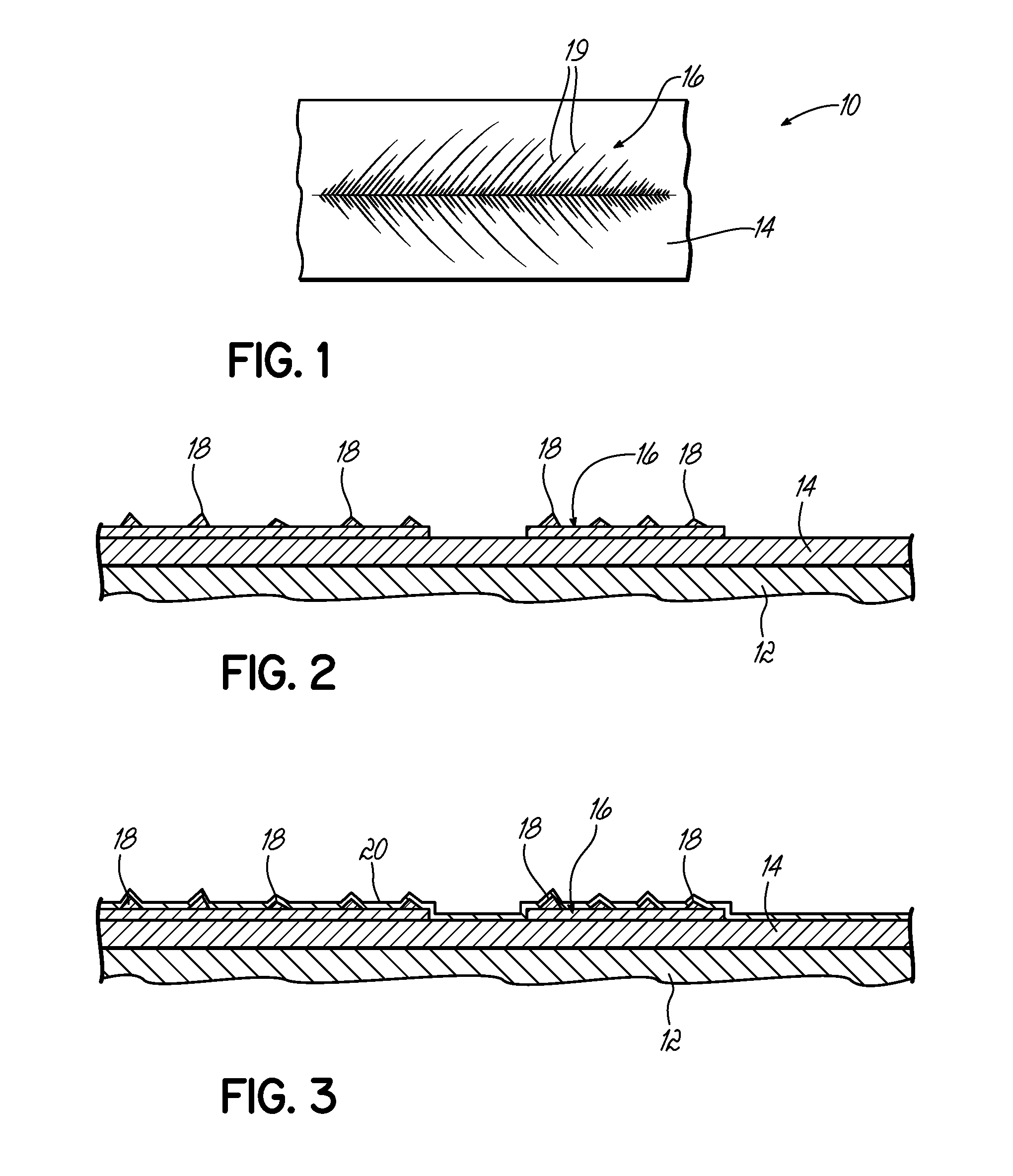 Method of treating cholangiocarcinoma and apparatus