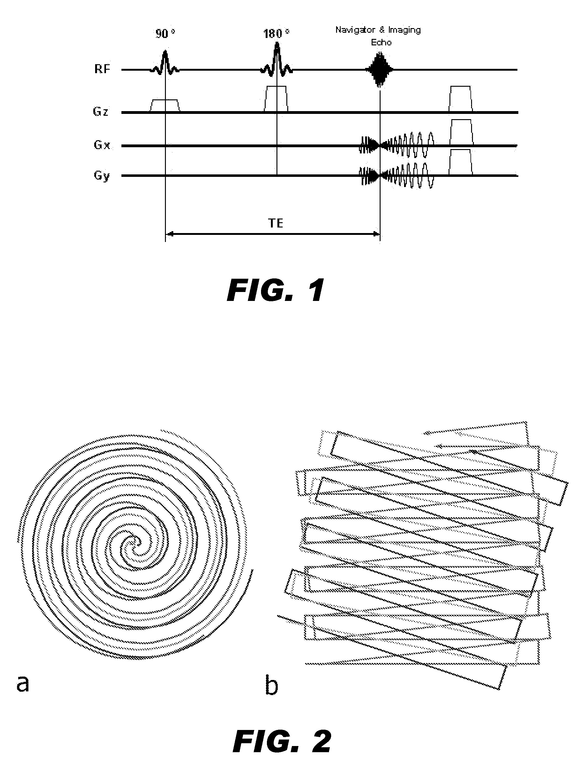 Motion corrected magnetic resonance imaging