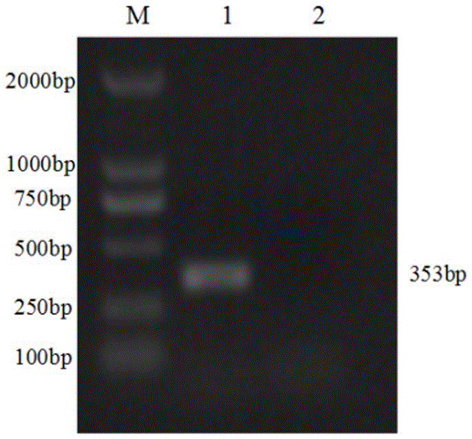 Dual fluorescence RT-PCR (Reverse Transcription-Polymerase Chain Reaction) detection method for PDCoV (porcine Delta coronavirus) and PEDV (porcine epidemic diarrhea virus) and application thereof