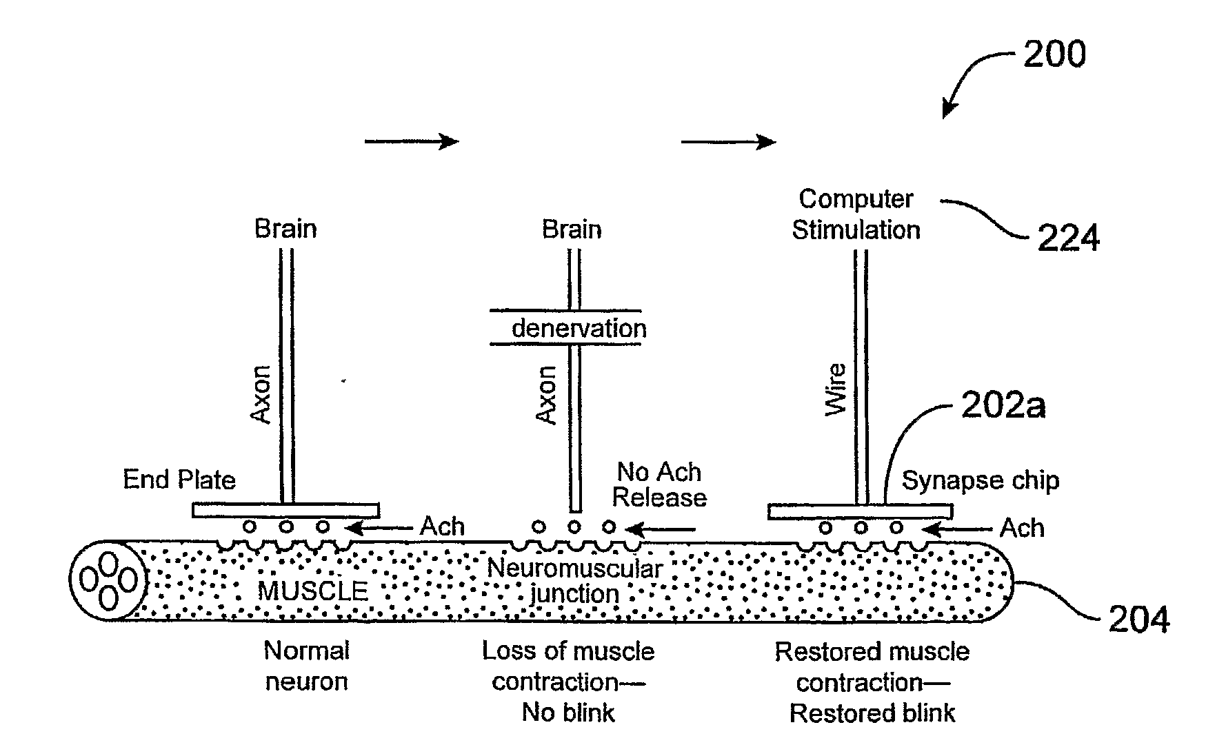 Devices and Methods for Stimulation of Tissue