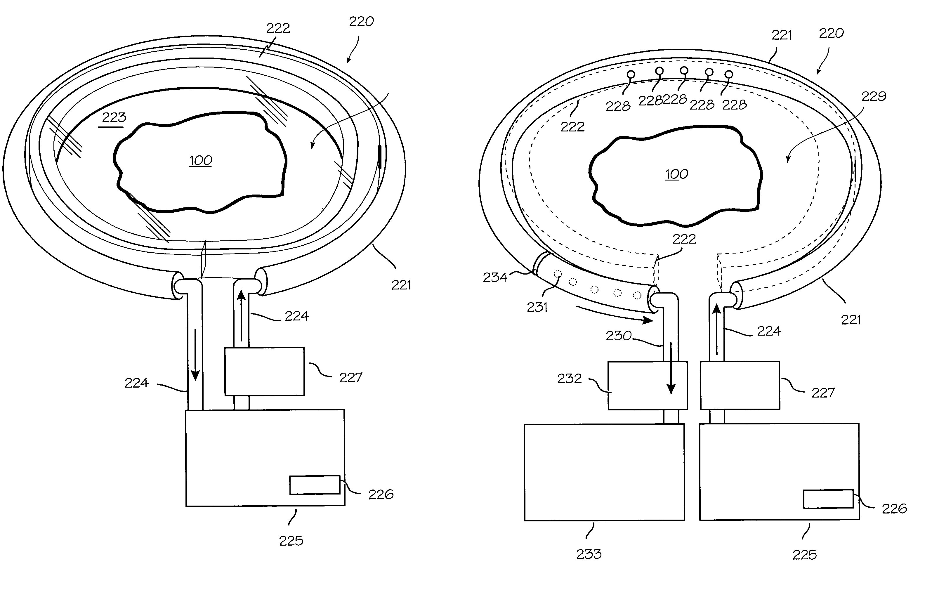 Wound shield and warming apparatus and method