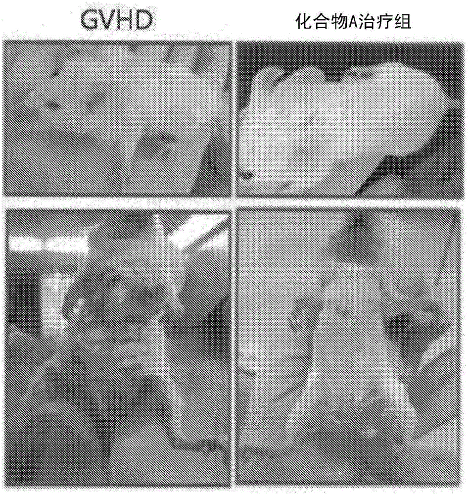 Pharmaceutical composition for inhibiting immune response through inducing differentiation into regulator t cells and promoting proliferation of regulator t cells