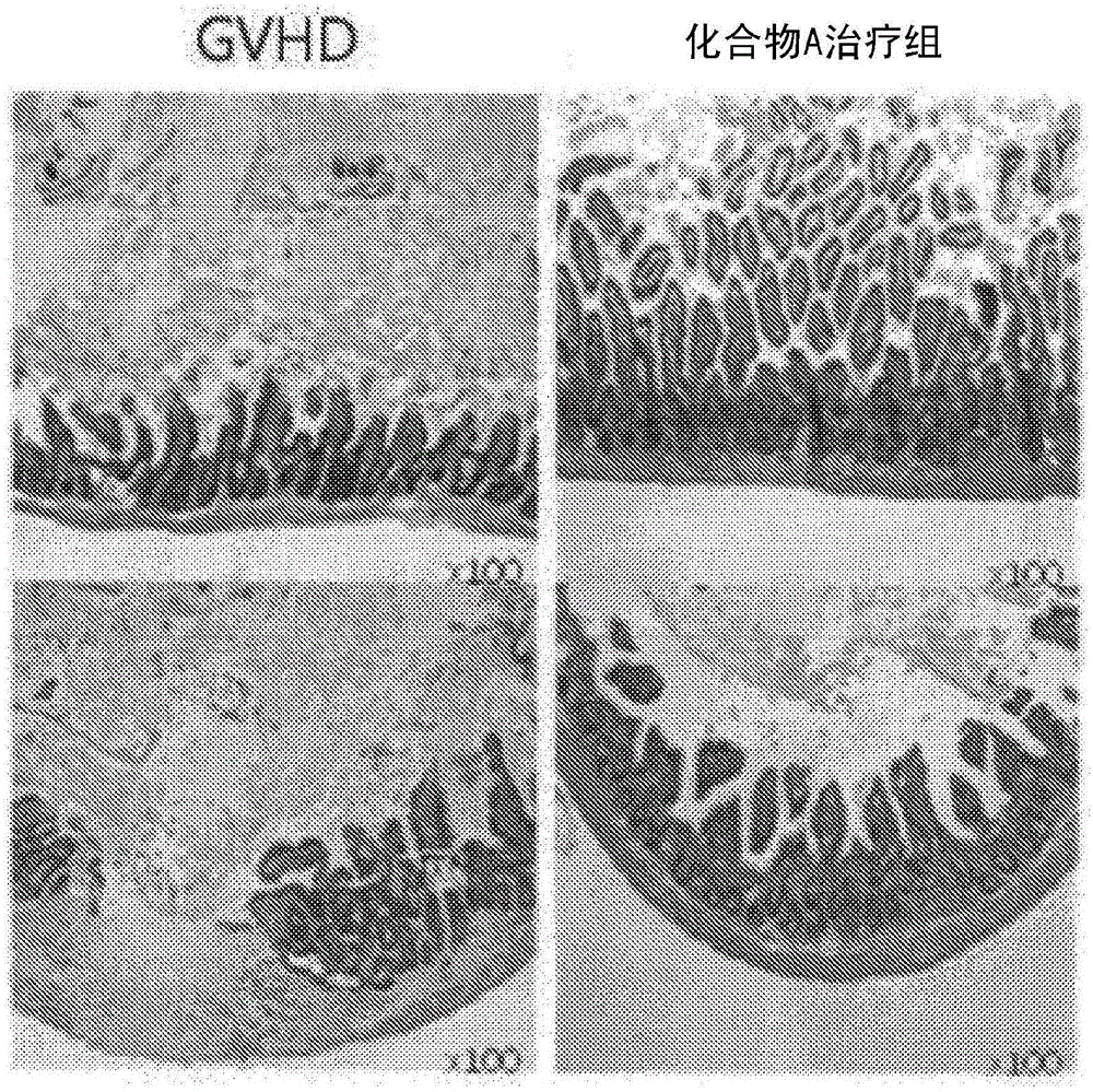 Pharmaceutical composition for inhibiting immune response through inducing differentiation into regulator t cells and promoting proliferation of regulator t cells