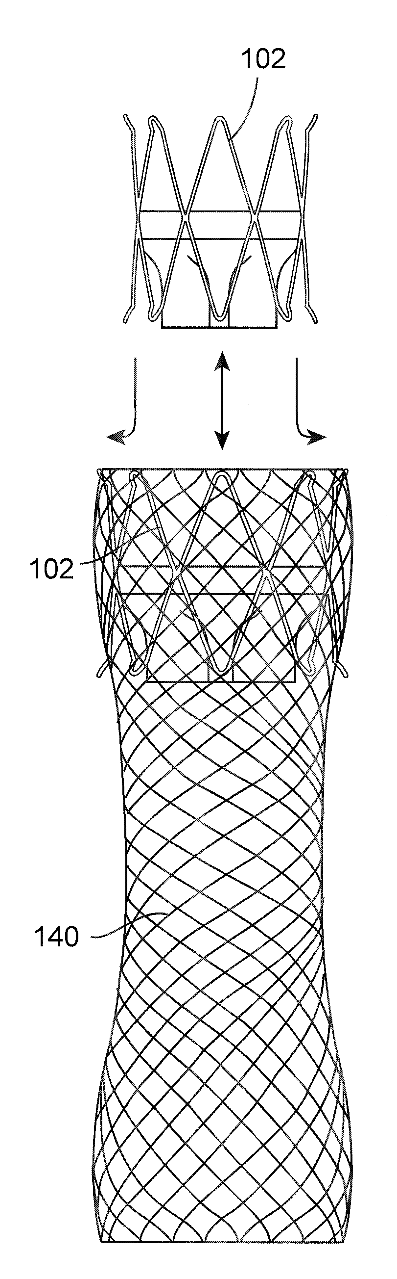 Gastrointestinal implant device