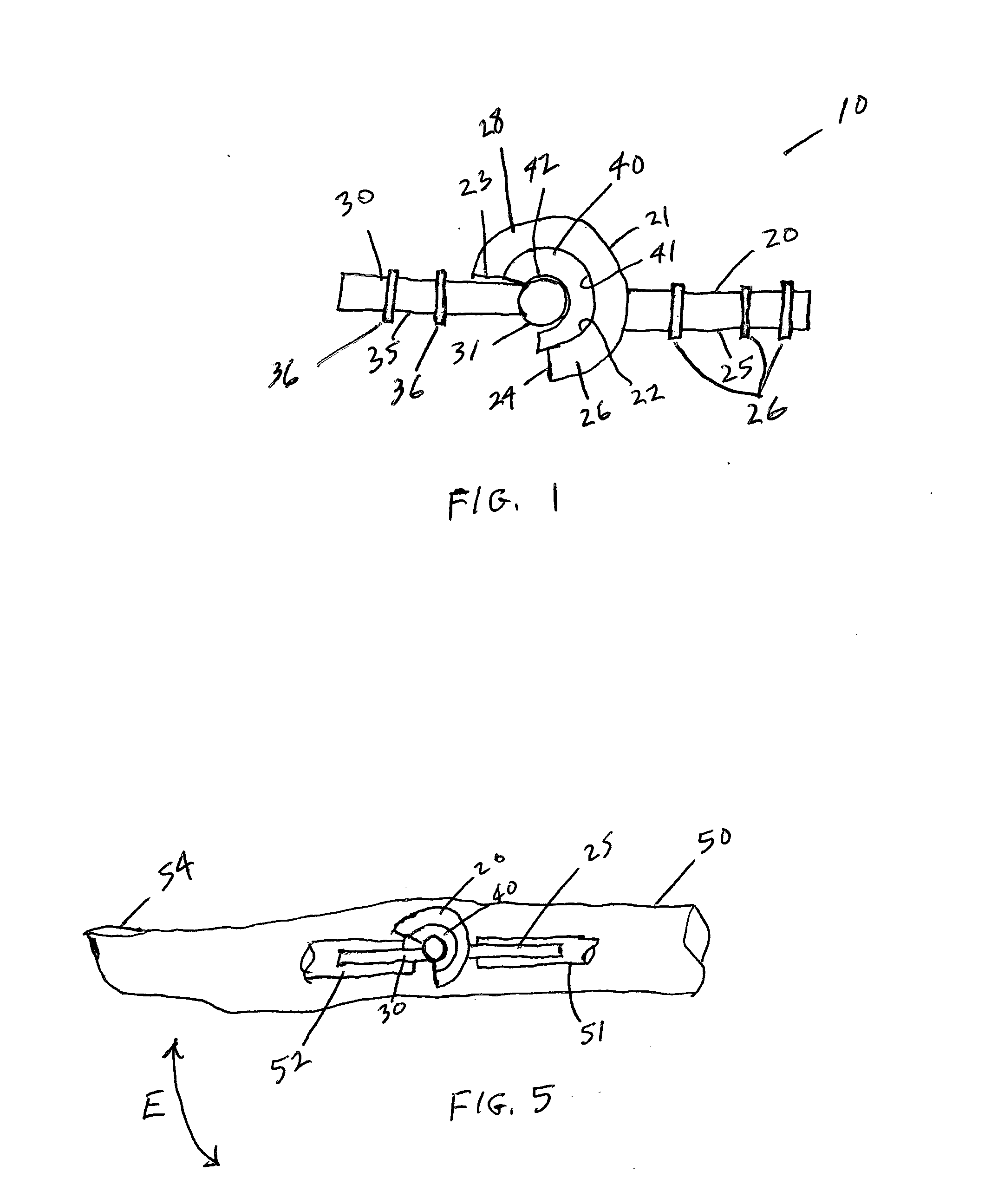 Implants and Methods of Making and Using the Same