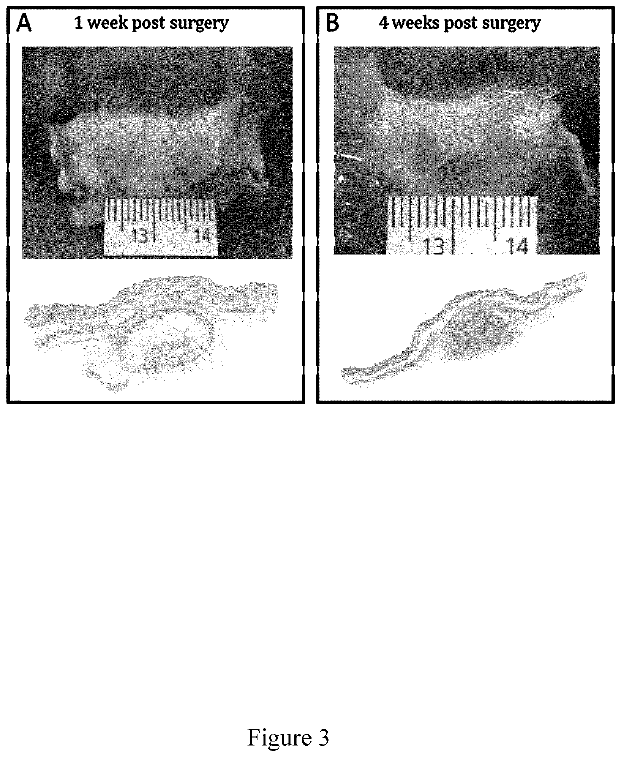 Decellularised cell wall structures from plants and fungus and use thereof as scaffold materials