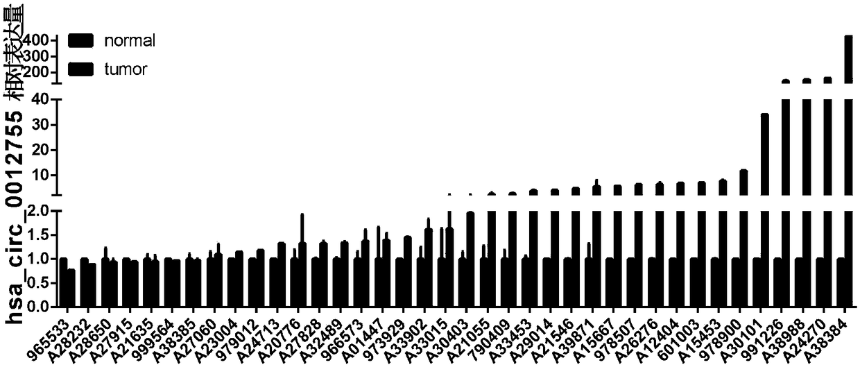 Application of hsa_circ_0012755 as prostatic cancer molecular target in preparing medicine and kit