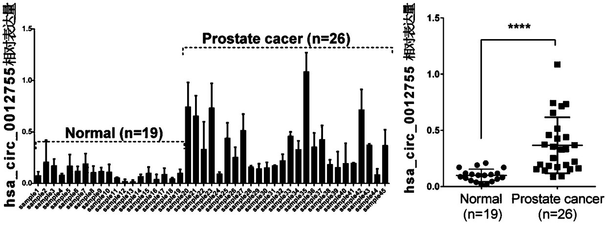 Application of hsa_circ_0012755 as prostatic cancer molecular target in preparing medicine and kit