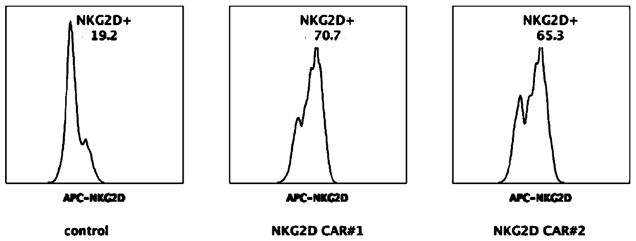 Construction and application of third-generation NKG2D chimeric antigen receptor T or NK cell