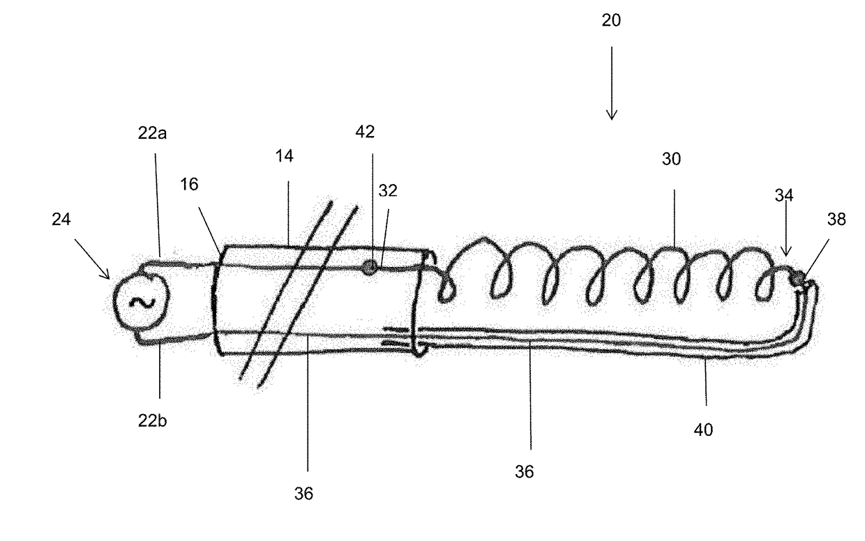 Electrochemical protection of conducting circuit in the body of a patient