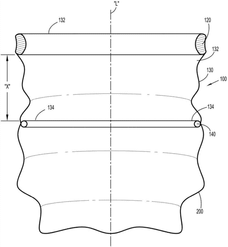 Wound retractor and specimen bag assembly