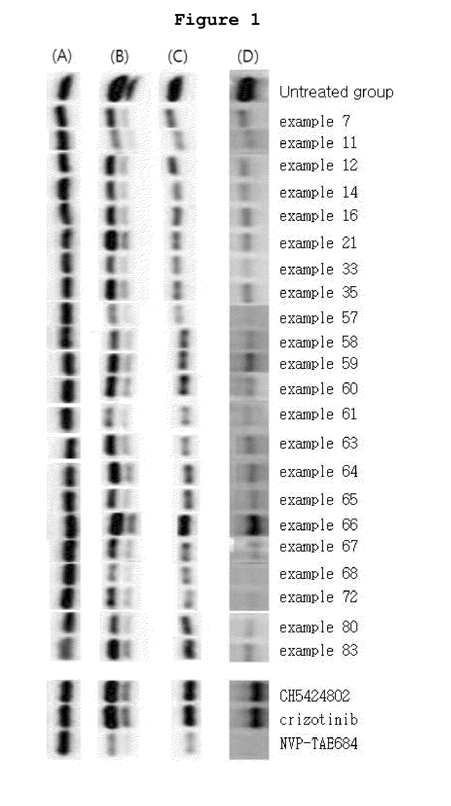 N2,N4-bis(4-(piperazine-1-yl)phenyl)pirimidine-2,4-diamine derivative or pharmaceutically acceptable salt thereof, and composition containing same as active ingredient for preventing or treating cancer