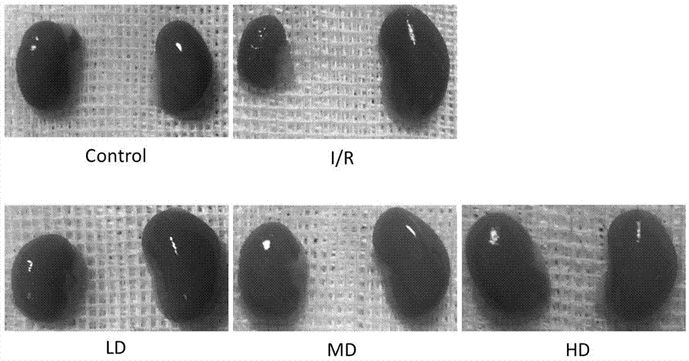 Application of dextromethorphan hydrobromide to treatment of acute and chronic renal fibrosis