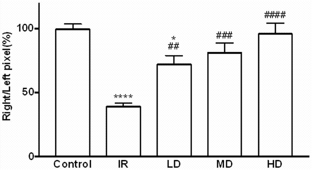 Application of dextromethorphan hydrobromide to treatment of acute and chronic renal fibrosis