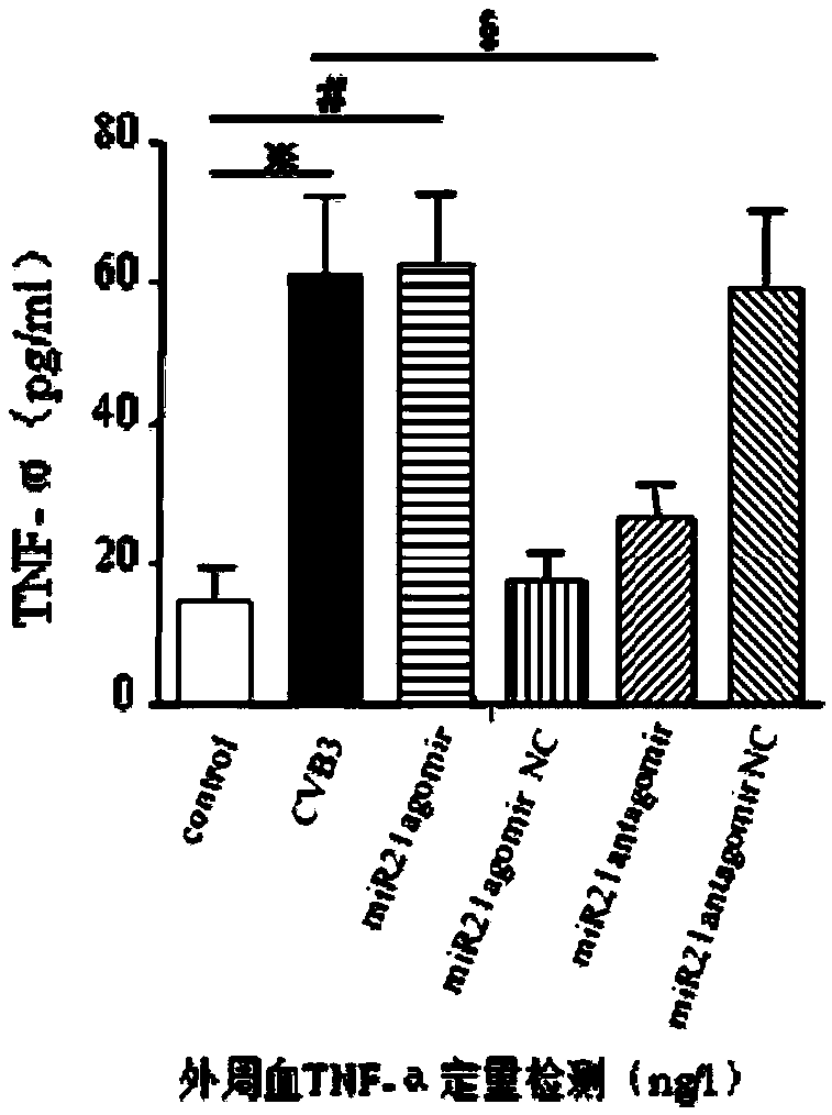 Targeted treating medicine for cardiac microangiopathy caused by Coxsackie B3 virus infection