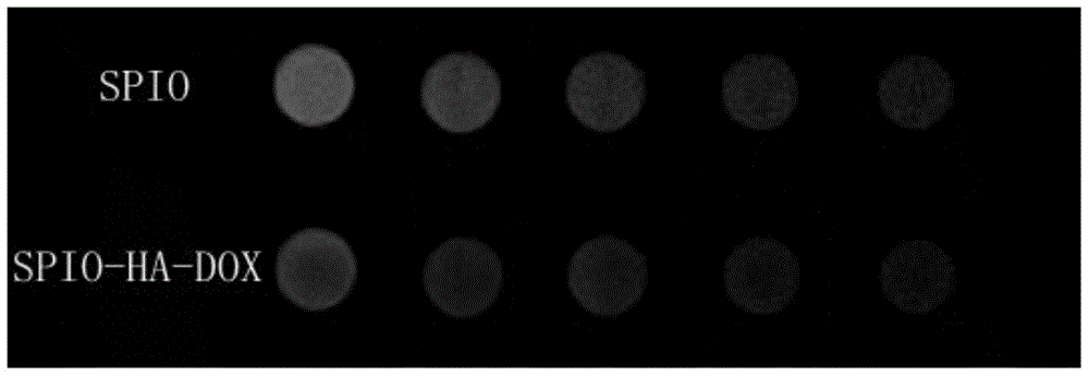 Preparation method of tumor-targeted acid-sensitivity prodrug-magnetic nanoparticle conjugate and application thereof