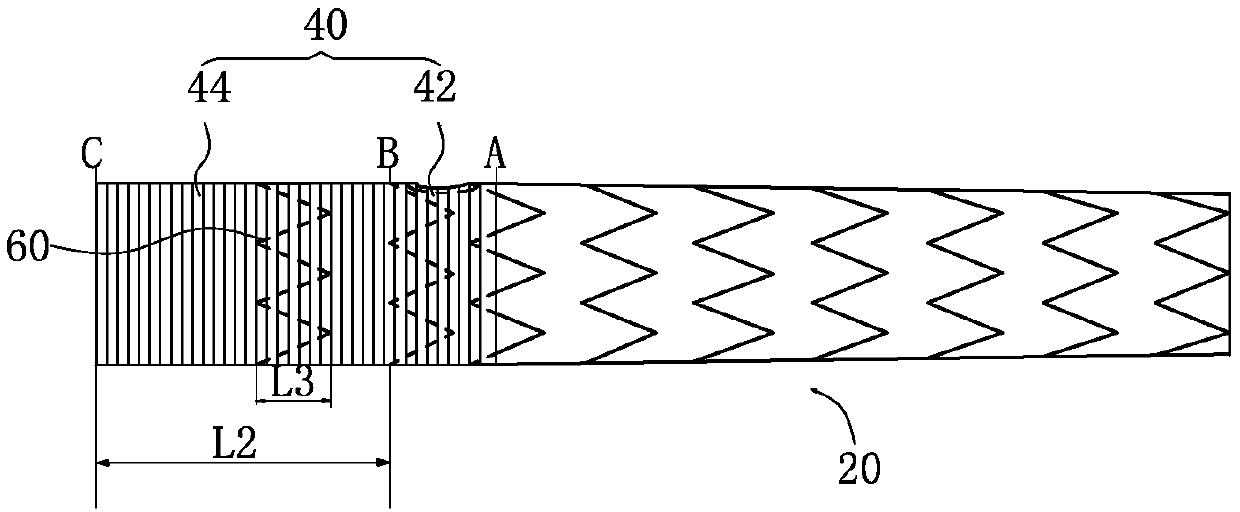 Intraoperative stent