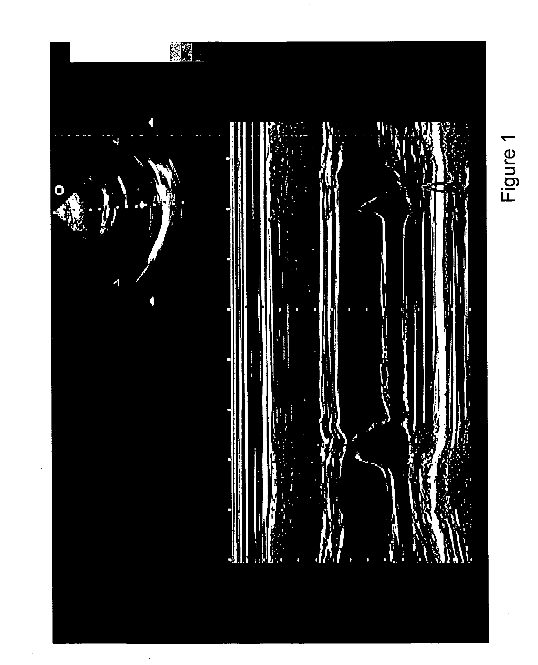 Measurement method of time varying events in a target body and a method for displaying measurement data of different parameters of a target in which time dependent events occur