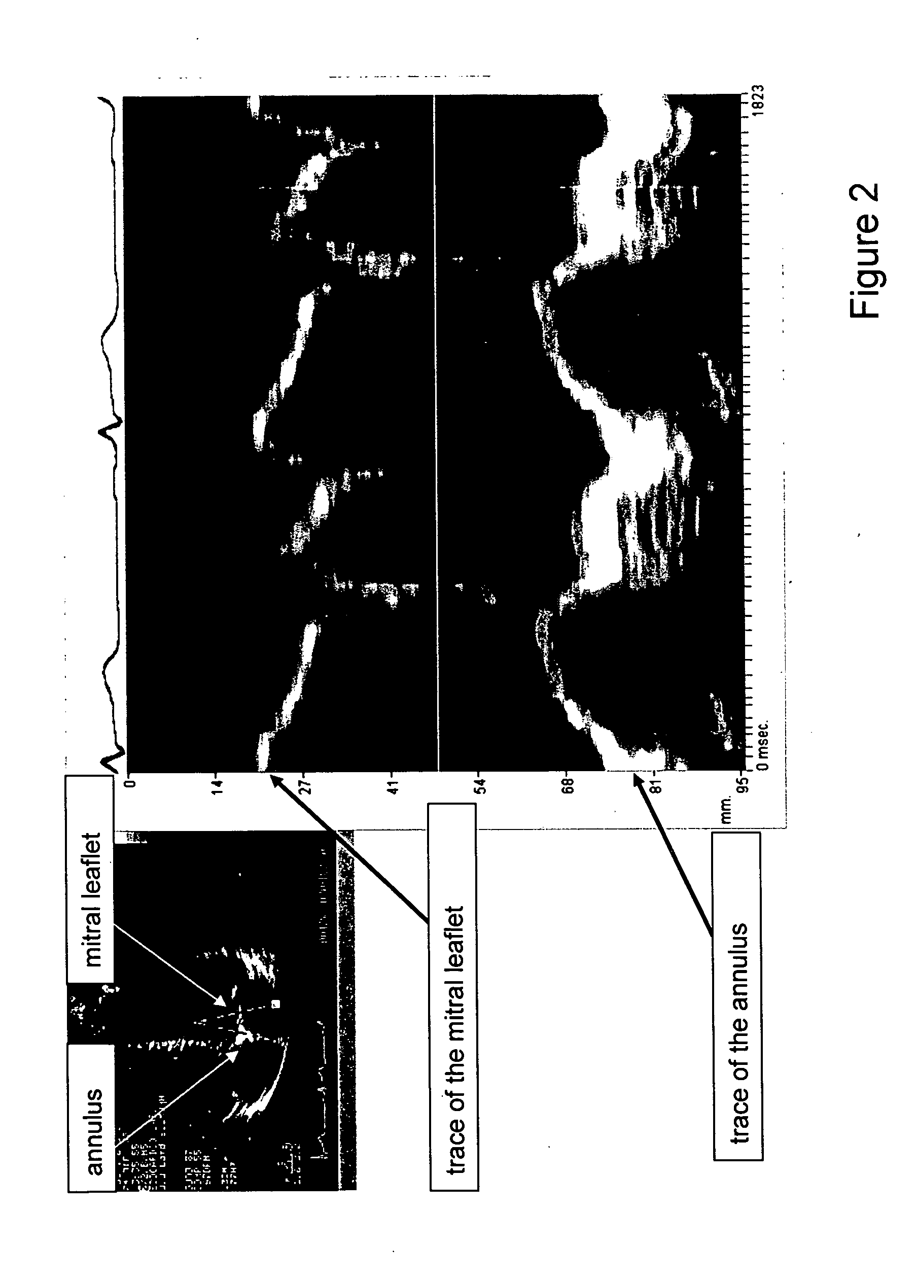 Measurement method of time varying events in a target body and a method for displaying measurement data of different parameters of a target in which time dependent events occur