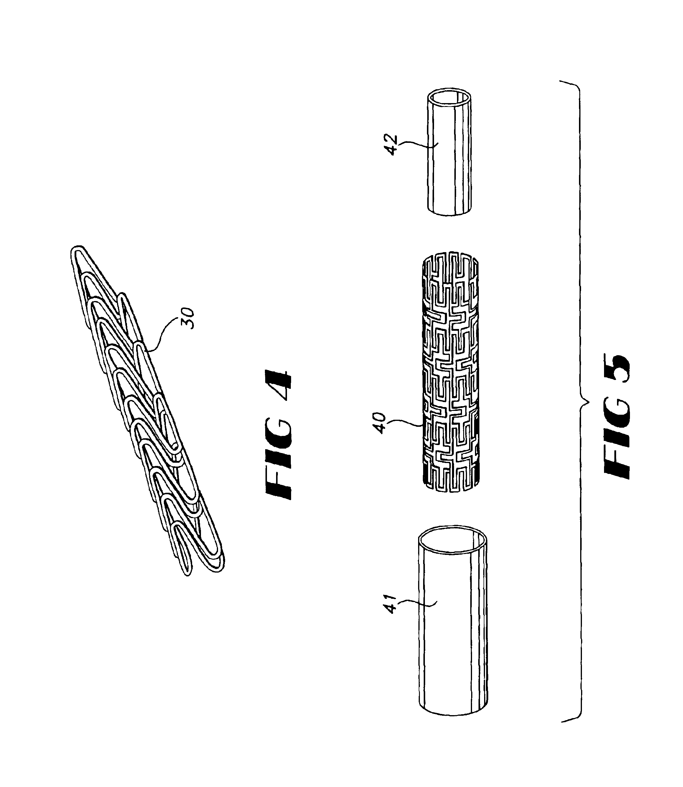 Stent with controlled expansion