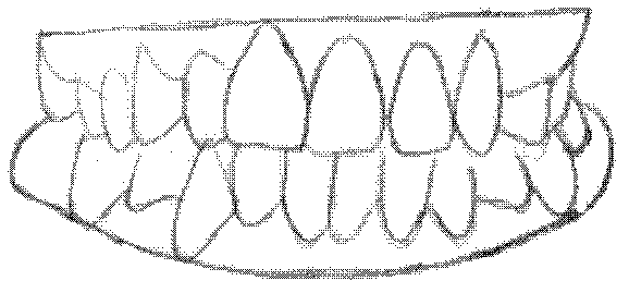 Correction method for preventing excessive stress concentration of teeth roots and jaws in process of orthodontic treatment