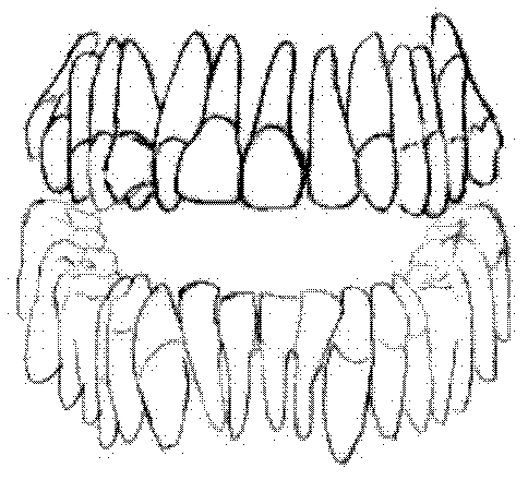 Correction method for preventing excessive stress concentration of teeth roots and jaws in process of orthodontic treatment